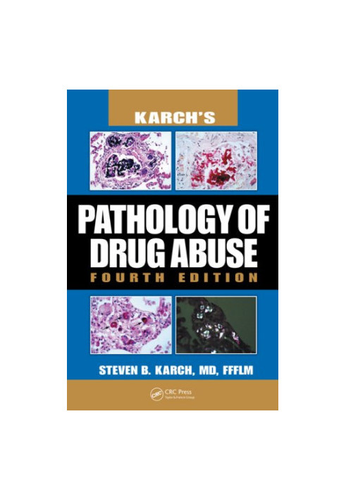 Karch's Pathology of Drug Abuse, Fourth Edition