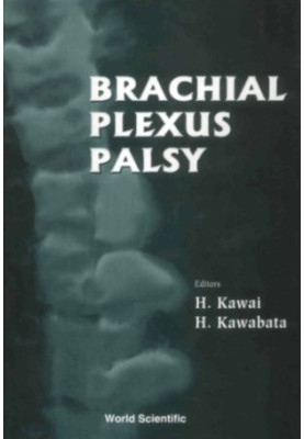 Brachial plexus palsy