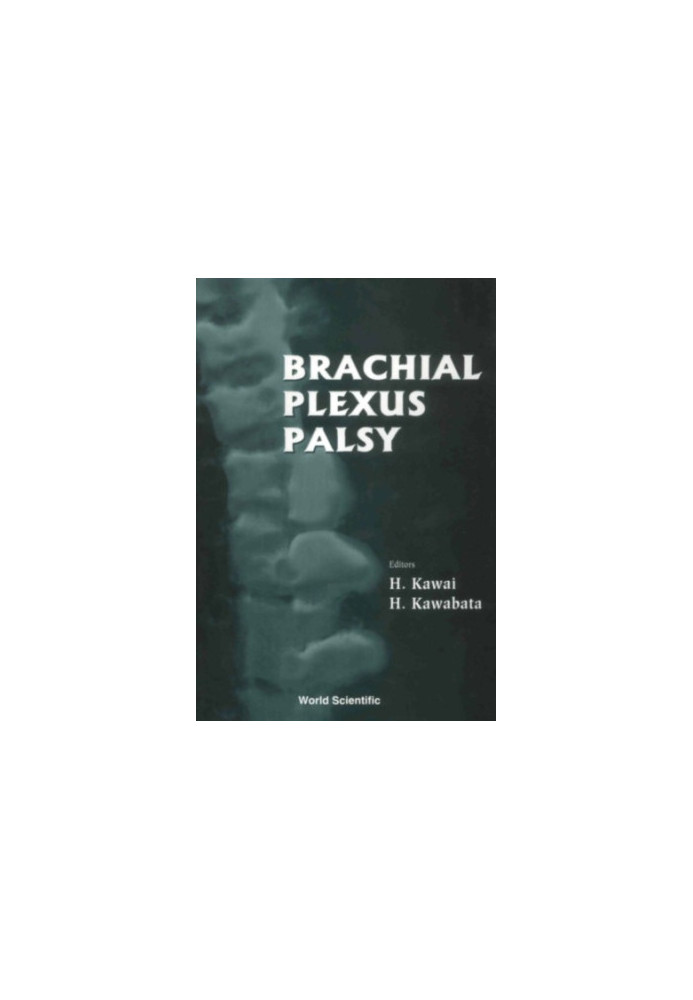 Brachial plexus palsy
