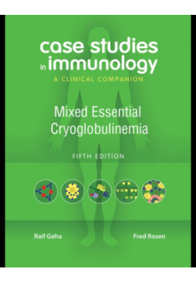Case studies in immunology: a clinical companion: mixed essential cryoglobulinemia