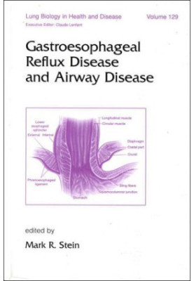 Gastroesophageal Reflux Disease and Airway Disease