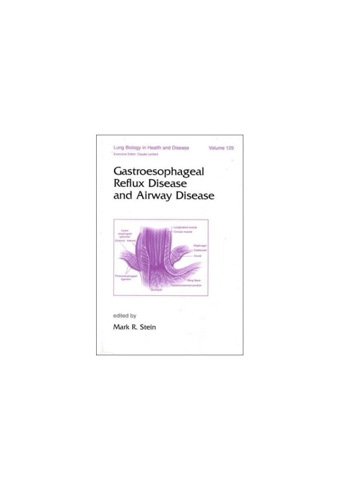 Gastroesophageal Reflux Disease and Airway Disease