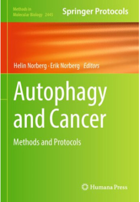 Autophagy and Cancer: Methods and Protocols