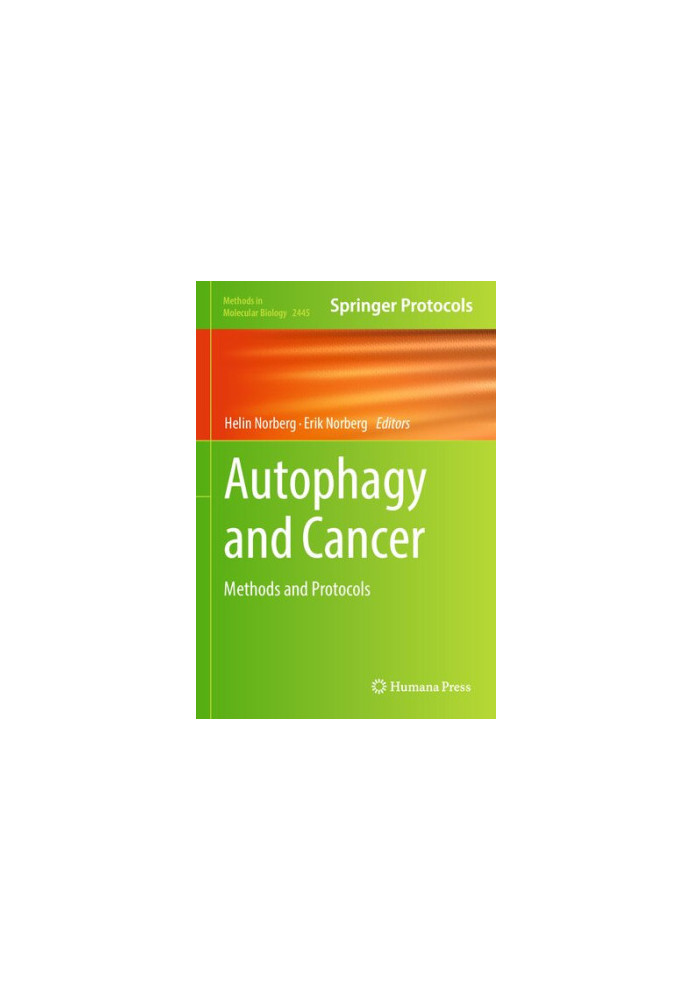 Autophagy and Cancer: Methods and Protocols