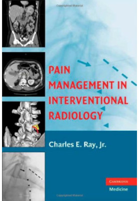 Pain Management in Interventional Radiology