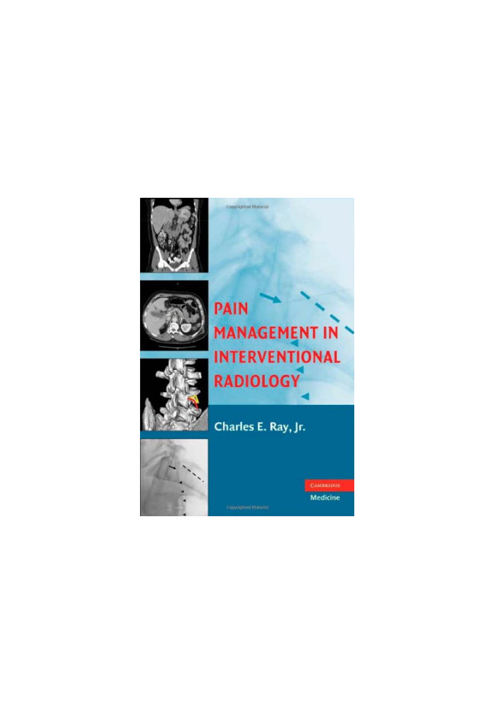 Pain Management in Interventional Radiology