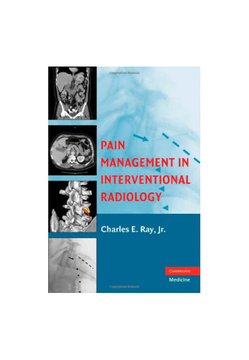 Pain Management in Interventional Radiology