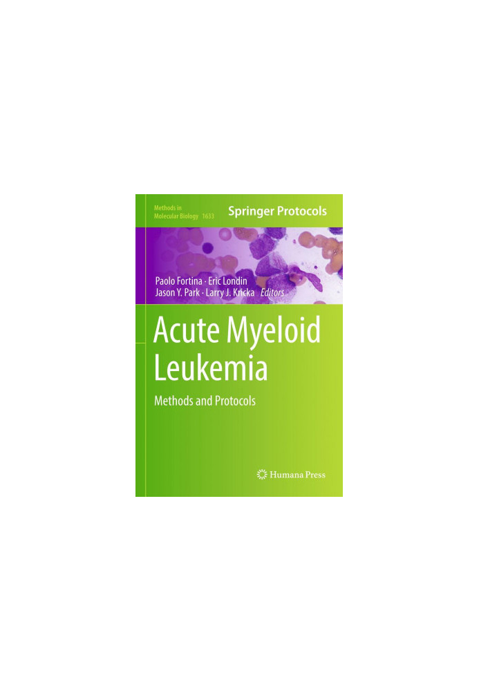 Acute myeloid leukemia : methods and protocols