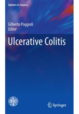 Ulcerative Colitis