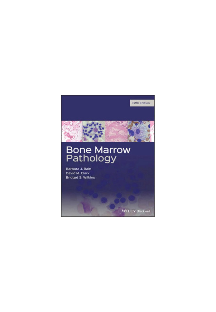 Bone Marrow Pathology