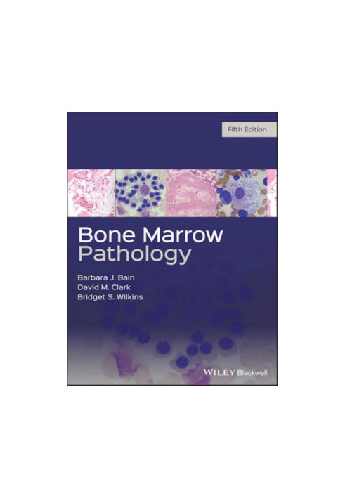 Bone Marrow Pathology
