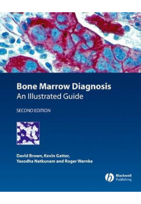 Bone Marrow Diagnosis: An Illustrated Guide, Second Edition