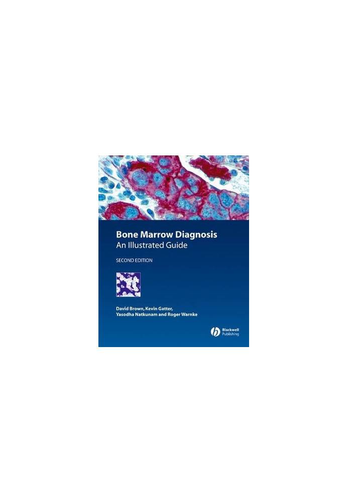 Bone Marrow Diagnosis: An Illustrated Guide, Second Edition