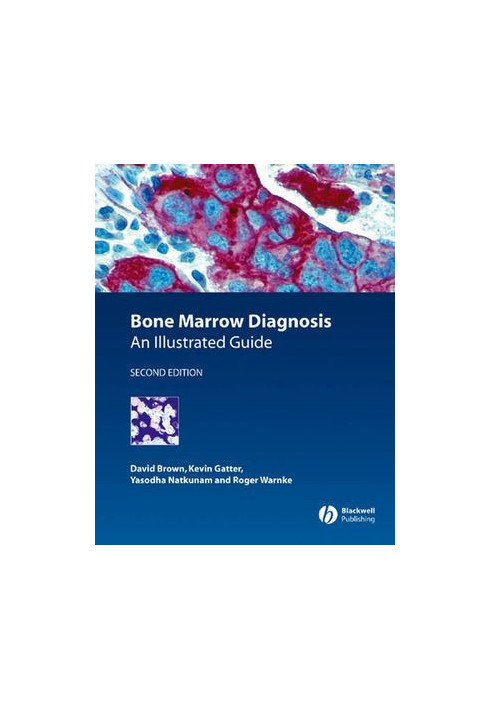 Bone Marrow Diagnosis: An Illustrated Guide, Second Edition