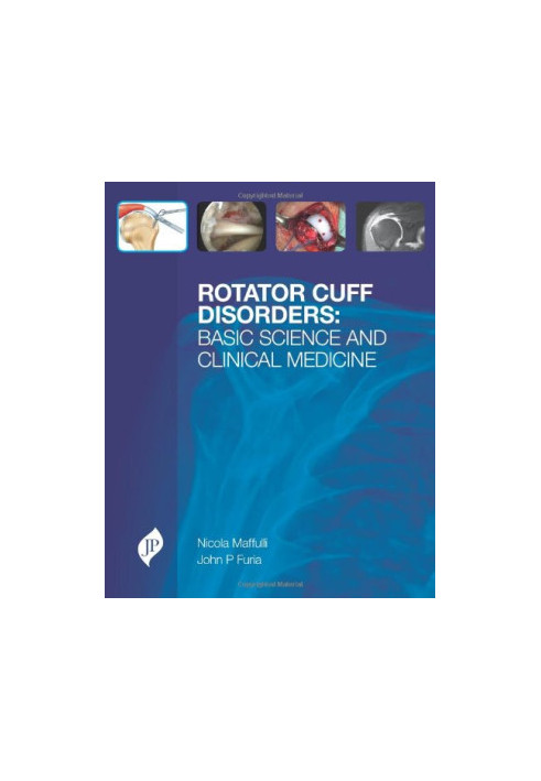 Rotator Cuff Disorders: Basic Science & Clinical Medicine