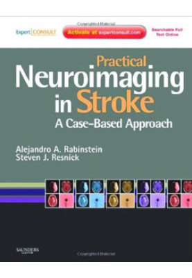 Practical Neuroimaging in Stroke