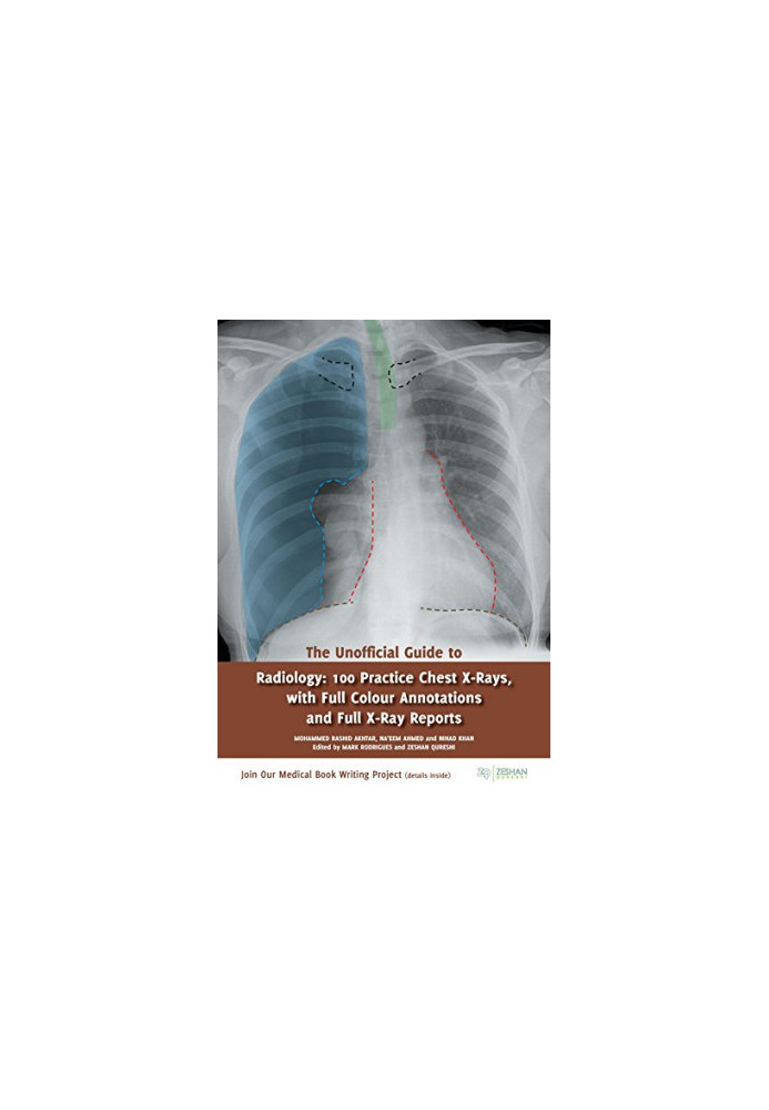 The Unofficial Guide to Radiology