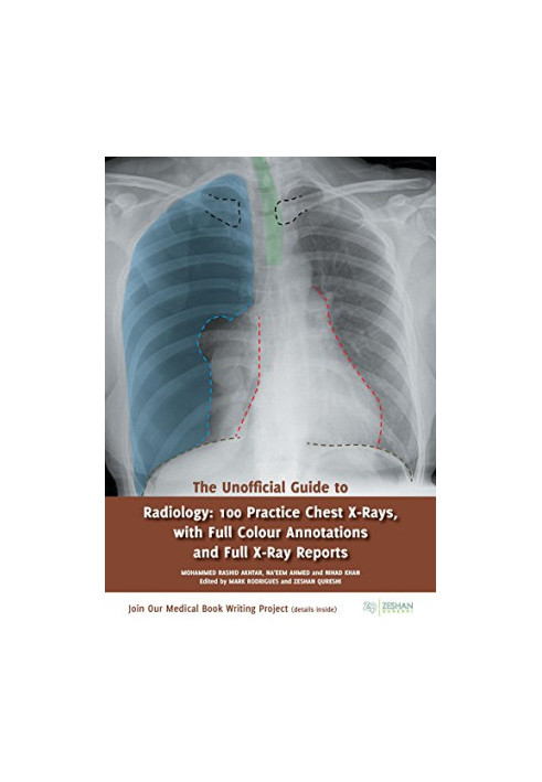 The Unofficial Guide to Radiology