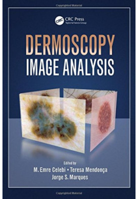 Dermoscopy image analysis