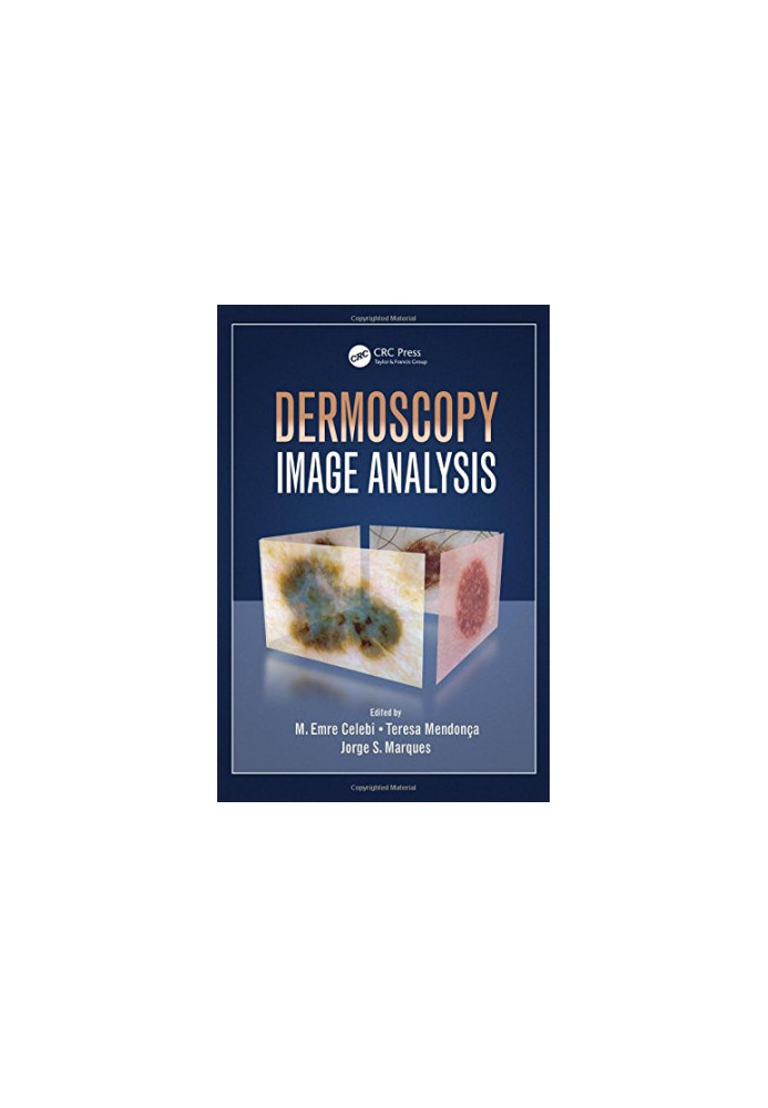 Dermoscopy image analysis