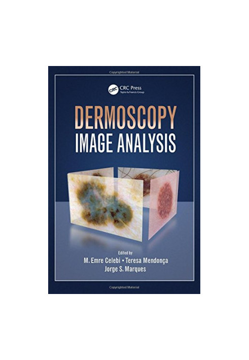 Dermoscopy image analysis