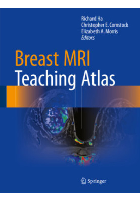 Breast MRI Teaching Atlas