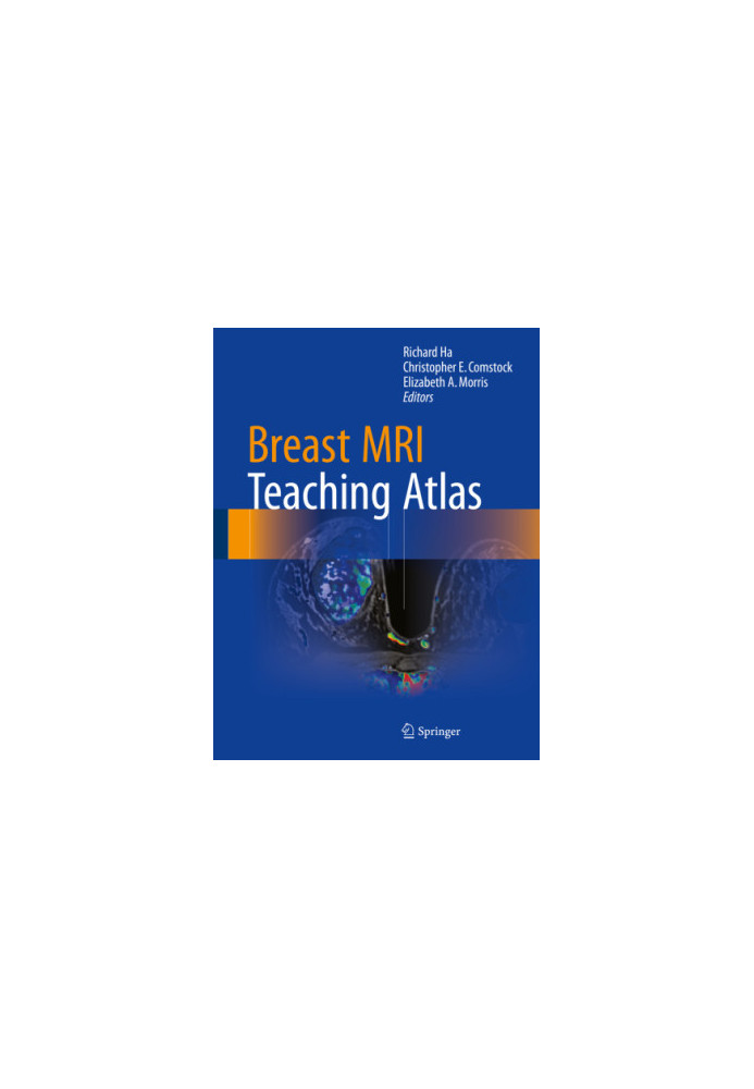 Breast MRI Teaching Atlas