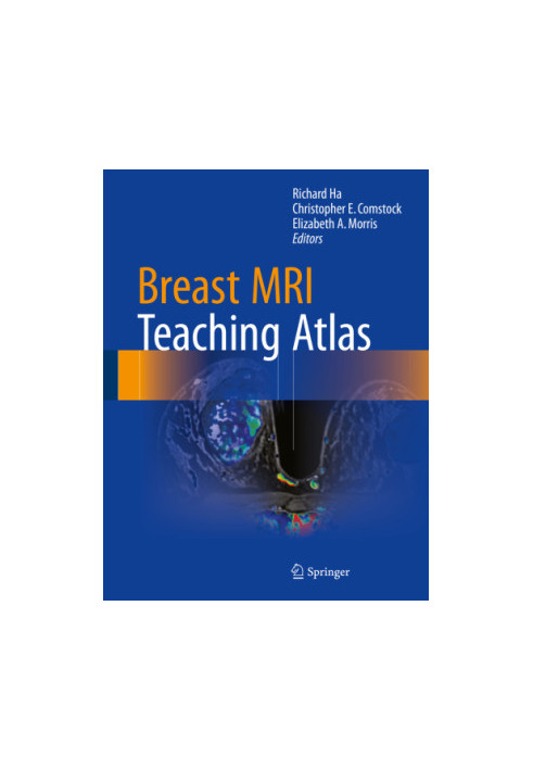 Breast MRI Teaching Atlas