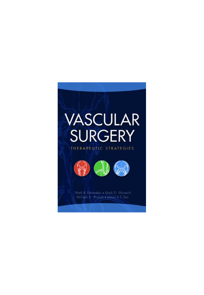 Vascular Surgery: Therapeutic Strategies