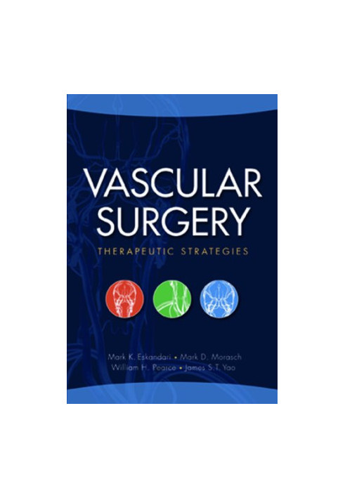 Vascular Surgery: Therapeutic Strategies