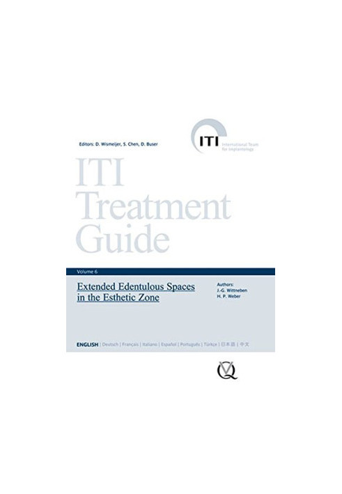 ITI Treatment Guide, Vol 6: Extended Edentulous Spaces in the Esthetic Zone (ITI Treatment Guides)