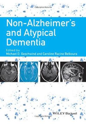 Non-Alzheimer's and atypical dementia