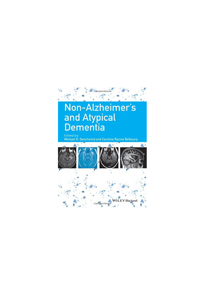 Non-Alzheimer's and atypical dementia