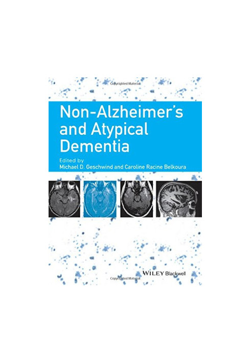 Non-Alzheimer's and atypical dementia