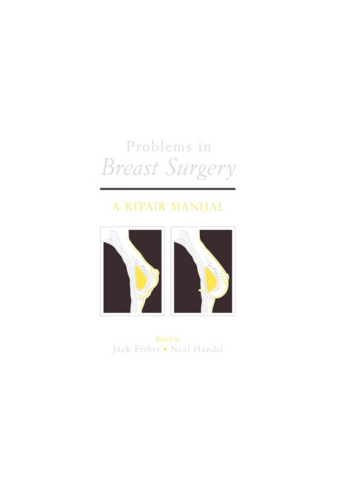 Problems in Breast Surgery : A Repair Manual
