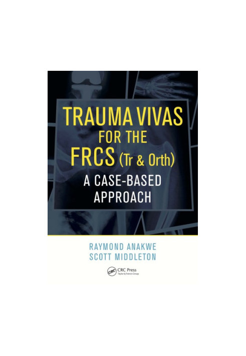Trauma Vivas for the FRCS : a Case-Based Approach