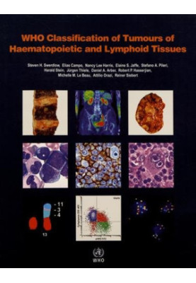 WHO Classification of Tumours of Haematopoietic and Lymphoid Tissues