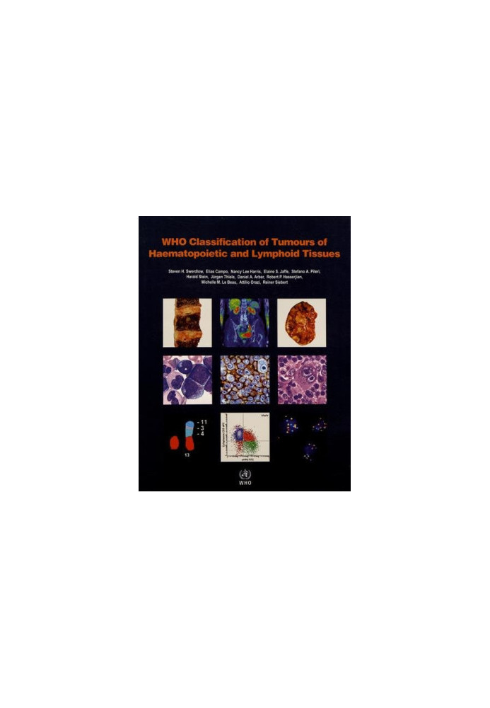WHO Classification of Tumours of Haematopoietic and Lymphoid Tissues