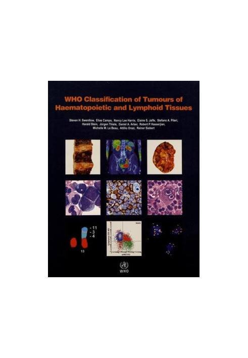 WHO Classification of Tumours of Haematopoietic and Lymphoid Tissues