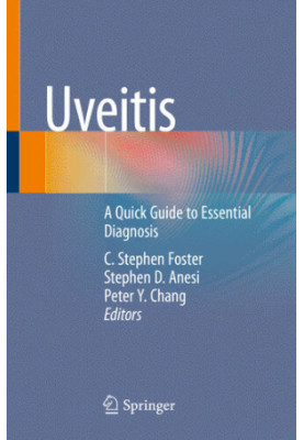 Uveitis: A Quick Guide to Essential Diagnosis