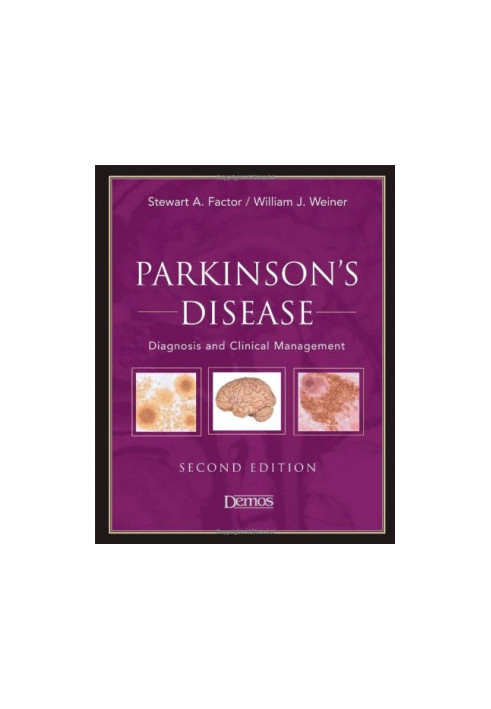 Parkinson s Disease-Diagnosis and Clinical Management