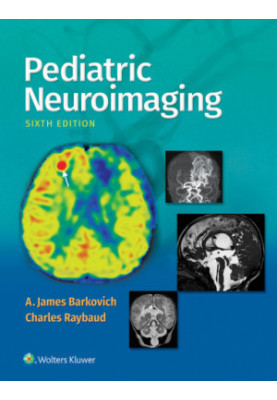 Pediatric Neuroimaging