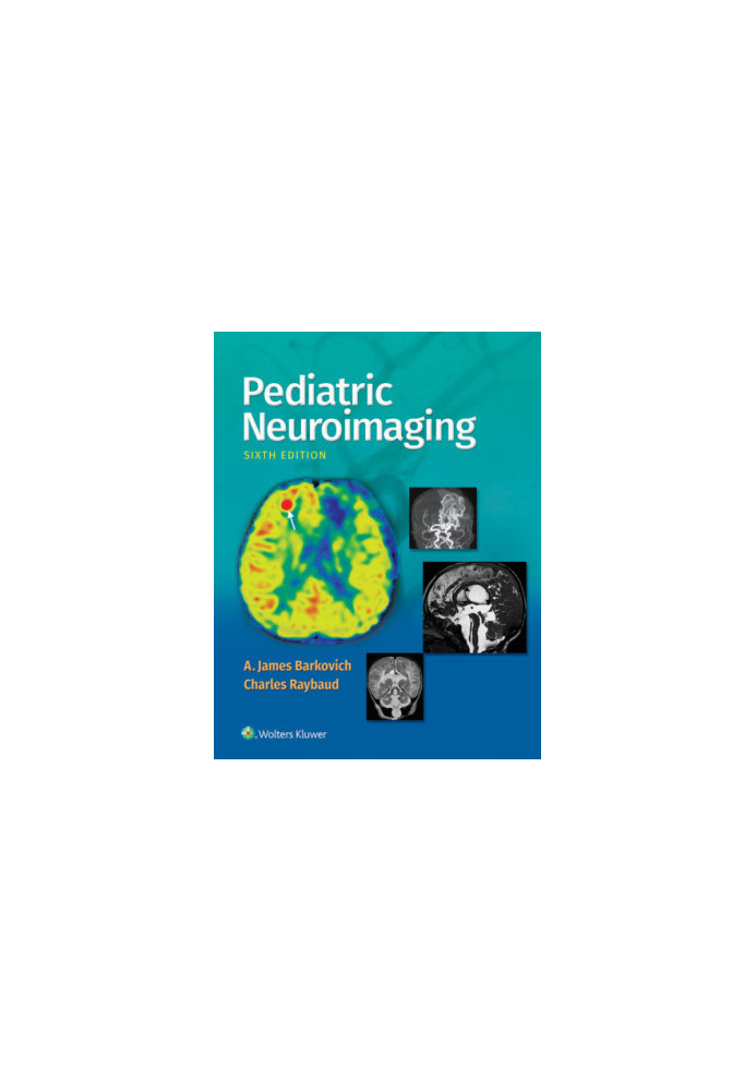 Pediatric Neuroimaging