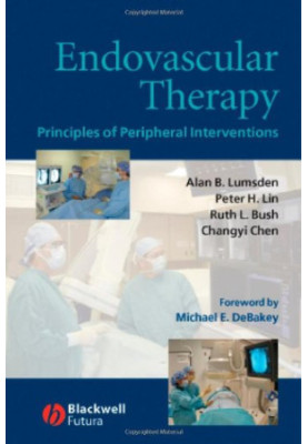 Endovascular Therapy: Principles of Peripheral Interventions