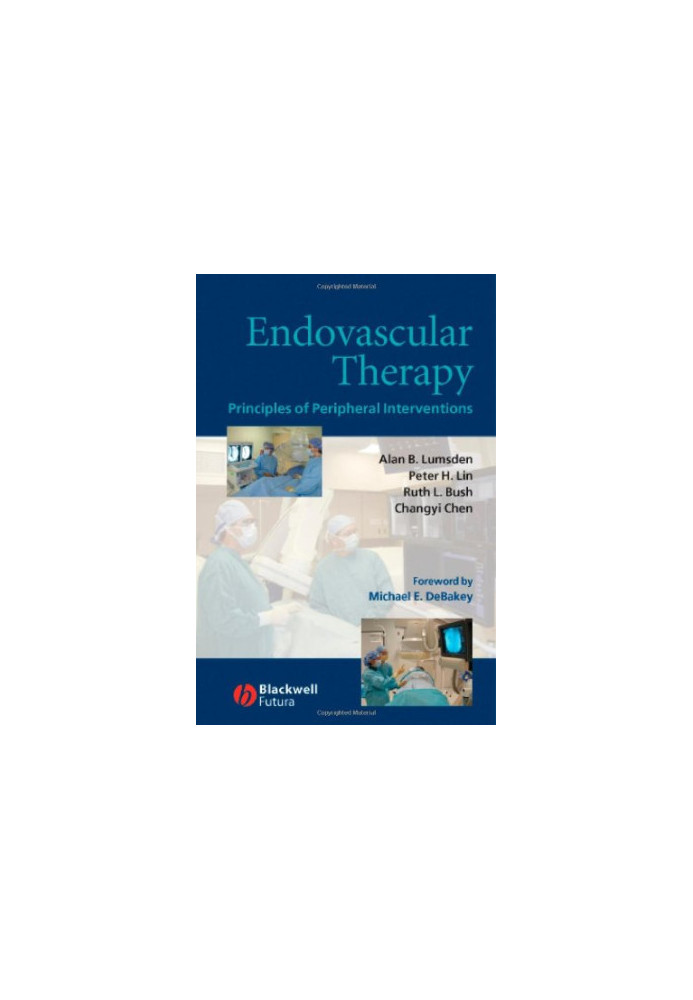 Endovascular Therapy: Principles of Peripheral Interventions