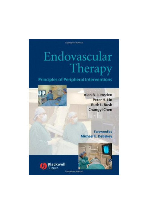 Endovascular Therapy: Principles of Peripheral Interventions