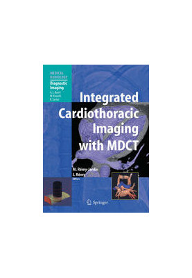 Integrated Cardiothoracic Imaging with MDCT
