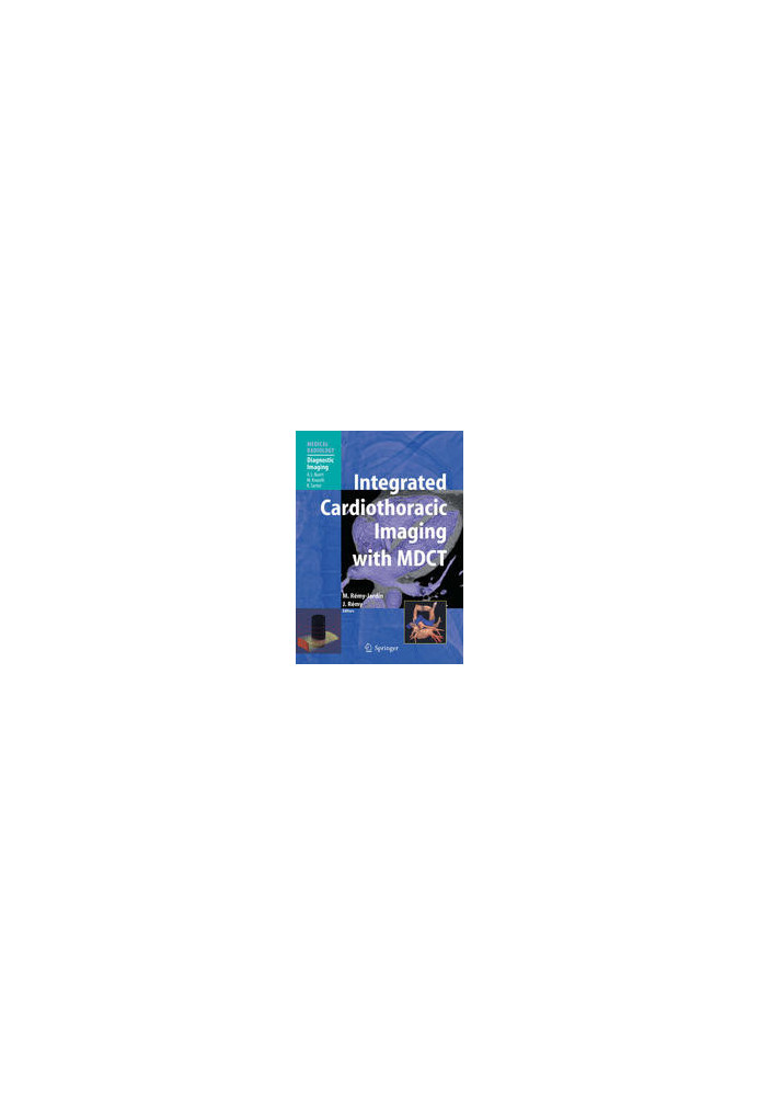 Integrated Cardiothoracic Imaging with MDCT