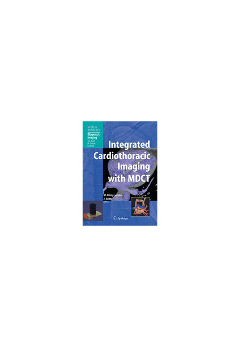 Integrated Cardiothoracic Imaging with MDCT
