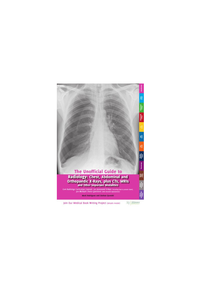 The Unofficial Guide to Radiology: Chest, Abdominal, Orthopaedic X Rays, plus CTs, MRIs and Other Important Modalities